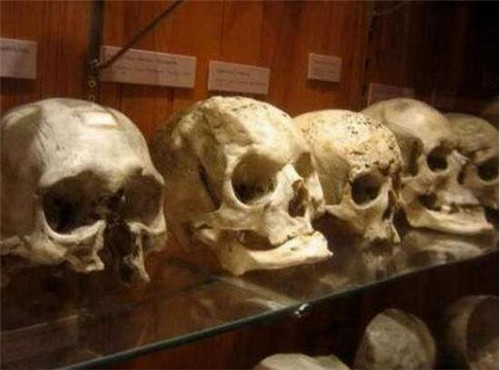 世界上最恐怖的博物馆：双头尸体，爱因斯坦大脑切片都在这