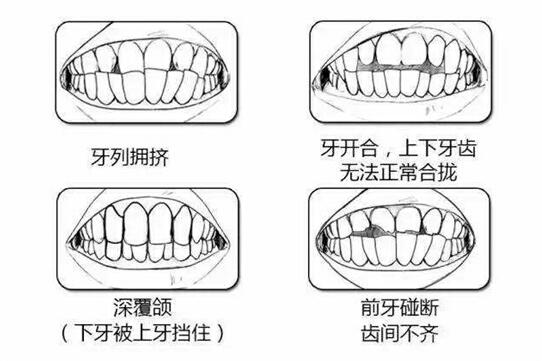 人有多少颗牙齿属于是正常的，如果牙齿多或少有什么影响